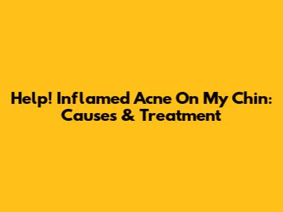 Help! Inflamed Acne On My Chin: Causes & Treatment