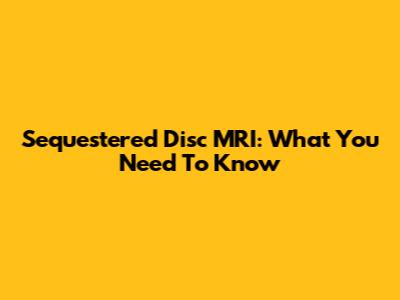 Sequestered Disc MRI: What You Need To Know